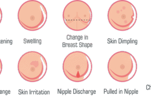 Think Pink this Month! Five Essential Truths About Breast Cancer