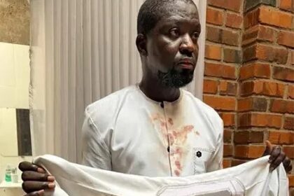 Ibrahim Mahama Meets Police Management Board Over Assault Allegations