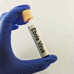 Health Ministry Urges Vigilance After WHO Declares Ebola Outbreak Global Health Emergency