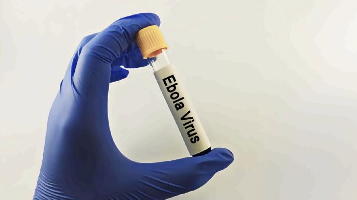 Health Ministry Urges Vigilance After WHO Declares Ebola Outbreak Global Health Emergency