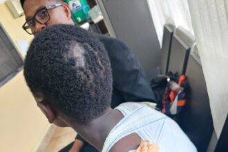 “No Child Deserves Such Pain and Trauma” — Dr. Sosu Supports Injured North Legon Teen
