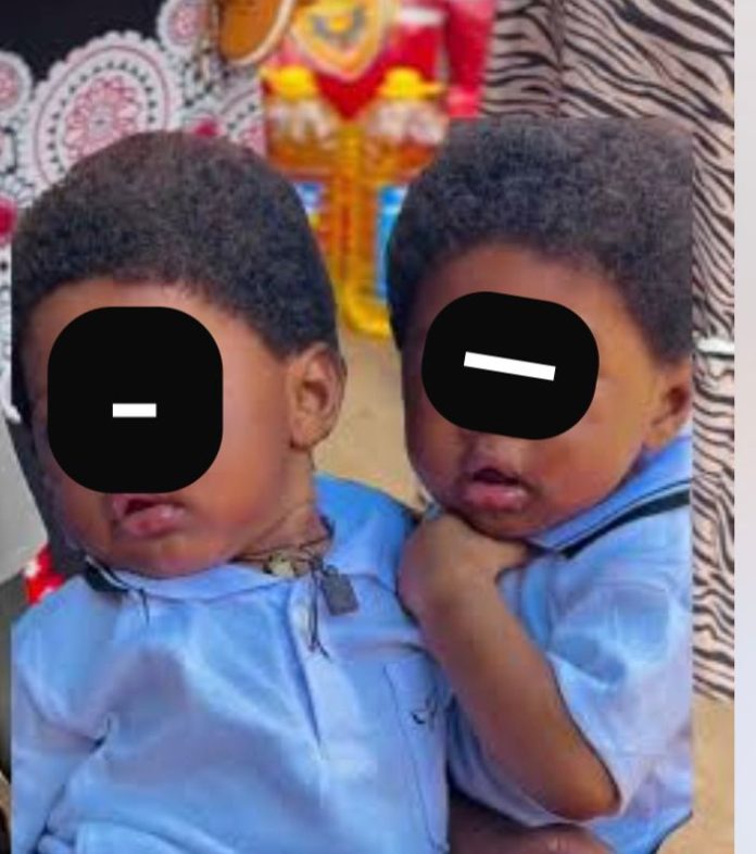DNA Results Reveal Twins With Different Fathers